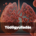 Tüdőgyulladás