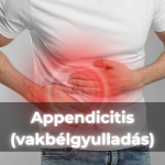 Appendicitis (vakbélgyulladás)