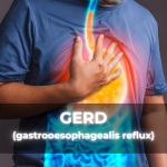 GERD (reflux)