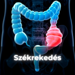 Székrekedés