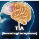 TIA